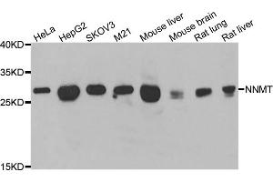 Western blot analysis of extracts of various cell lines, using NNMT antibody (ABIN5974021) at 1/1000 dilution. (NNMT 抗体)