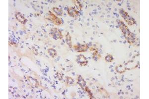Formalin-fixed and paraffin embedded human kidney labeled with Anti-PACAP-38 Polyclonal Antibody, Unconjugated  at 1:200 followed by conjugation to the secondary antibody and DAB staining.