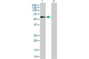 Western Blot analysis of HSFX1 expression in transfected 293T cell line by HSFX1 MaxPab polyclonal antibody. (HSFX1 抗体  (AA 1-423))