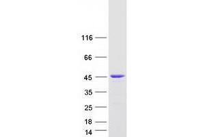 Western Blotting (WB) image for Discs, Large (Drosophila) Homolog-Associated Protein 4 (DLGAP4) (Transcript Variant 3) protein (Myc-DYKDDDDK Tag) (ABIN2719521)