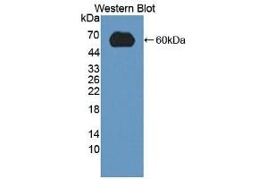 Detection of Recombinant LDLR, Mouse using Polyclonal Antibody to Low Density Lipoprotein Receptor (LDLR) (LDLR 抗体  (AA 263-509))