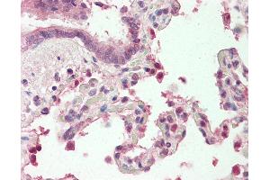 Human, Lung: Formalin-Fixed Paraffin-Embedded (FFPE). (MZF1 抗体  (N-Term))