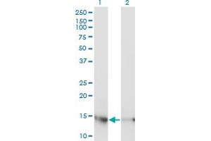 Western Blot analysis of UBE2D3 expression in transfected 293T cell line by UBE2D3 monoclonal antibody (M01), clone 4C1-1E3. (UBE2D3 抗体  (AA 1-147))