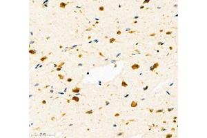 Immunohistochemistry (Paraffin-embedded Sections) (IHC (p)) image for anti-NAC alpha Domain Containing (NACAD) antibody (ABIN7074756)
