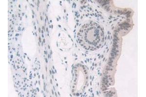 Detection of NPM1 in Mouse Uterus Tissue using Polyclonal Antibody to Nucleophosmin 1 (NPM1)