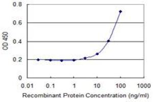 Detection limit for recombinant GST tagged KRT13 is 1 ng/ml as a capture antibody. (Cytokeratin 13 抗体  (AA 258-357))