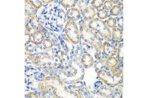 Immunohistochemistry of paraffin-embedded rat kidney using SMYD1 antibody (ABIN6128707, ABIN6148163, ABIN6148165 and ABIN6219496) at dilution of 1:200 (40x lens). (SMYD1 抗体  (AA 1-350))