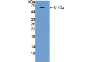 Western blot analysis of recombinant Human MR. (NR3C2 抗体  (AA 739-984))