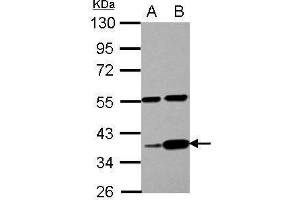WB Image Sample (30 ug of whole cell lysate) A: PC-3 B: U87-MG 10% SDS PAGE antibody diluted at 1:1000 (LUZP4 抗体)