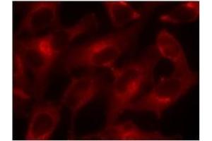 Image no. 2 for anti-Eukaryotic Translation Initiation Factor 4E (EIF4E) (Ser209) antibody (ABIN197473) (EIF4E 抗体  (Ser209))