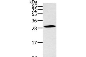 Western blot analysis of Mouse stomach tissue using YRDC Polyclonal Antibody at dilution of 1:400 (YRDC 抗体)