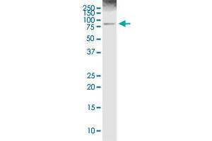 Western Blotting (WB) image for anti-Arachidonate 5-Lipoxygenase (ALOX5) (AA 1-674) antibody (ABIN513267)