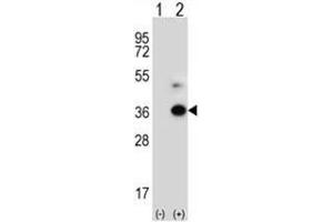 Western blot analysis of ANGPTL7 (arrow) using rabbit polyclonal ANGPTL7 Antibody (C-term) . (ANGPTL7 抗体  (C-Term))