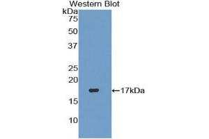 WB of Protein Standard: different control antibodies against Highly purified E. (TGFB3 ELISA 试剂盒)