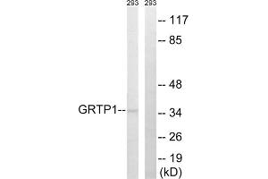 Western blot analysis of extracts from 293 cells, using GRTP1 antibody. (GRTP1 抗体  (Internal Region))