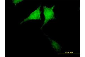 Immunofluorescence of purified MaxPab antibody to CARD8 on HeLa cell. (CARD8 抗体  (AA 1-392))