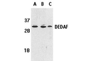 Western Blotting (WB) image for anti-RING1 and YY1 Binding Protein (RYBP) antibody (ABIN1031706) (RYBP 抗体)