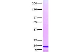 Validation with Western Blot (CCL14 蛋白)