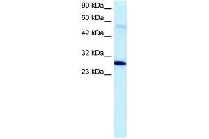 PARP1 antibody used at 5 ug/ml to detect target protein. (PARP1 抗体)