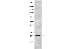Western blot analysis of MED28 using MCF7 whole cell lysates (MED28 抗体  (Internal Region))