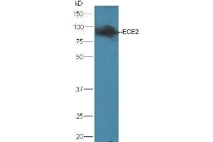 Mouse brain lysates probed with Rabbit Anti-ECE2 Polyclonal Antibody, Unconjugated (ABIN733958) at 1:300 overnight at 4 °C. (ECE2 抗体  (AA 601-700))