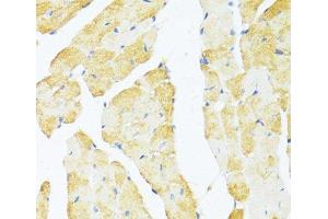 Immunohistochemistry of paraffin-embedded Mouse heart using DDX3Y Polyclonal Antibody at dilution of 1:100 (40x lens). (DDX3Y 抗体)