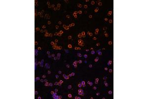 Immunofluorescence (IF) image for anti-Ectonucleoside Triphosphate diphosphohydrolase 1 (ENTPD1) (AA 1-180) antibody (ABIN1679729)
