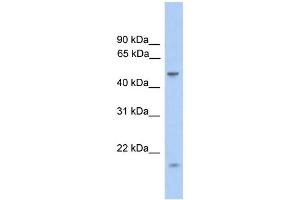 WB Suggested Anti-ZNF213 Antibody Titration:  0. (ZNF213 抗体  (Middle Region))