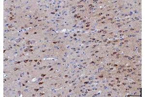 IHC analysis of LNPEP using anti-LNPEP antibody (ABIN7600279). (LNPEP 抗体  (AA 17-994))