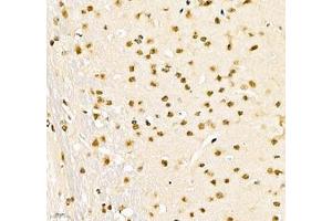 Immunohistochemistry (Paraffin-embedded Sections) (IHC (p)) image for anti-Poly A Binding Protein Nuclear 1 (PABPN1) antibody (ABIN7075116)