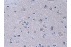 Immunohistochemistry (IHC) image for anti-Tyrosyl-tRNA Synthetase (Yars) (AA 2-528) antibody (ABIN7443434)