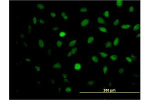 Immunofluorescence of monoclonal antibody to MEIS2 on HeLa cell. (MEIS2 抗体  (AA 1-381))