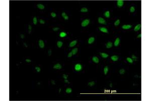 Immunofluorescence of monoclonal antibody to MEIS2 on HeLa cell.