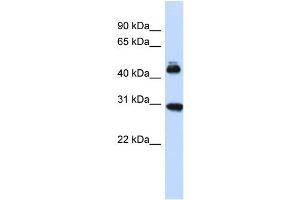 Host:  Rabbit  Target Name:  CBX4  Sample Type:  Fetal Brain lysates  Antibody Dilution:  1. (CBX4 抗体  (Middle Region))
