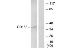Western blot analysis of extracts from RAW264. (TNFSF8 抗体  (AA 71-120))
