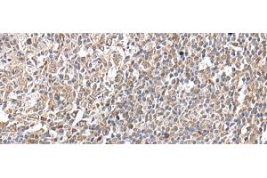 Immunohistochemistry of paraffin-embedded Human tonsil tissue using GNAI2 Polyclonal Antibody at dilution of 1:25(x200) (GNAI2 抗体)