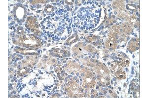 SARDH antibody was used for immunohistochemistry at a concentration of 4-8 ug/ml. (SARDH 抗体  (Middle Region))