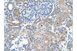 SARDH antibody was used for immunohistochemistry at a concentration of 4-8 ug/ml. (SARDH 抗体  (Middle Region))