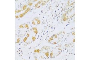 Immunohistochemistry of paraffin-embedded human stomach using FDXR antibody (ABIN5972045) at dilution of 1/100 (40x lens). (Ferredoxin Reductase 抗体)