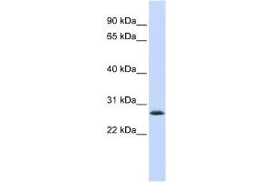 LSM12 antibody used at 1 ug/ml to detect target protein. (LSM12B 抗体)
