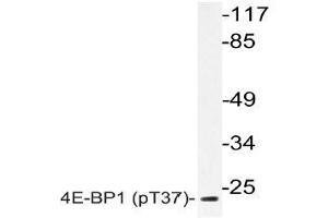 Western blot (WB) analyzes of p-4E-BP1 (pThr37) antibody in extracts from MDA-MB-435 EGF cells. (eIF4EBP1 抗体  (pThr37))