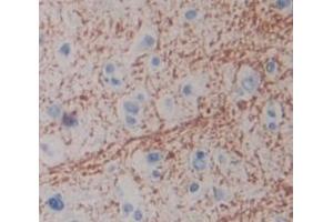 IHC-P analysis of Human Tissue, with DAB staining. (CPZ 抗体  (AA 425-652))