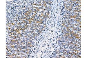 ABIN6261381 and ABIN6278681 at 1/100 staining rat stomach tissue by IHC-P.
