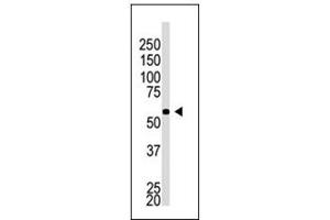 Image no. 1 for anti-beta-Site APP-Cleaving Enzyme 2 (BACE2) (C-Term), (Isoform C) antibody (ABIN358586) (BACE2 抗体  (C-Term, Isoform C))