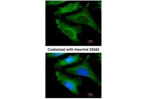 ICC/IF Image Immunofluorescence analysis of methanol-fixed HeLa, using IL1ra antagonist , antibody at 1:200 dilution.