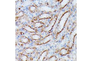 Immunohistochemistry of paraffin-embedded rat kidney using IDH3A antibody (ABIN7268029) at dilution of 1:100 (40x lens). (IDH3A 抗体  (AA 28-366))
