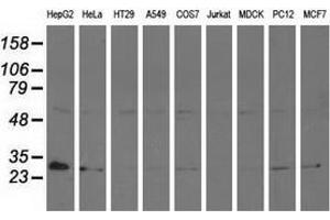 Western blot analysis of extracts (35 µg) from 9 different cell lines by using anti-AK3 monoclonal antibody. (Adenylate Kinase 3 抗体)