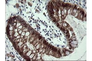 Image no. 5 for anti-Cytidine Monophosphate (UMP-CMP) Kinase 1, Cytosolic (CMPK1) antibody (ABIN1497544) (Cytidine Monophosphate (UMP-CMP) Kinase 1, Cytosolic (CMPK1) 抗体)