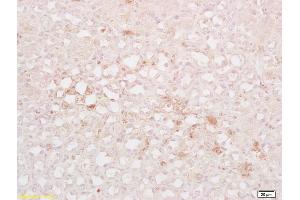 Formalin-fixed and paraffin embedded mouse kidney labeled with Rabbit Anti DRP1/DNM1L Polyclonal Antibody, Unconjugated  at 1:200 followed by conjugation to the secondary antibody and DAB staining (CSRP2 抗体  (AA 101-200))