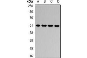 Western blot analysis of HADHB expression in HepG2 (A), Jurkat (B), mouse liver (C), rat liver (D) whole cell lysates. (HADHB 抗体)